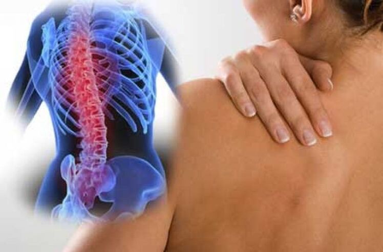 При остеохондрозі больовий синдром може віддавати у віддалені ділянки тіла