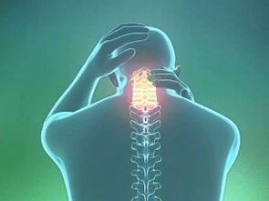 Симптомом шийного остеохондрозу є головний біль