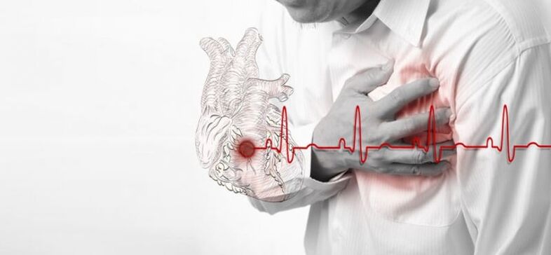 серцевий напад як причина болю під лівою лопаткою