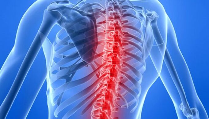 Патології хребта – найпоширеніші причини болю у спині в області лопаток