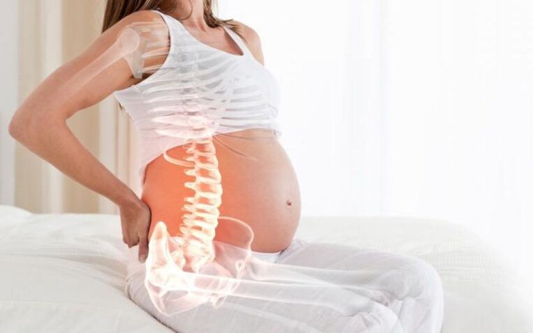 У вагітних жінок болить хребет між лопатками через підвищені навантаження на м'язи спини. 