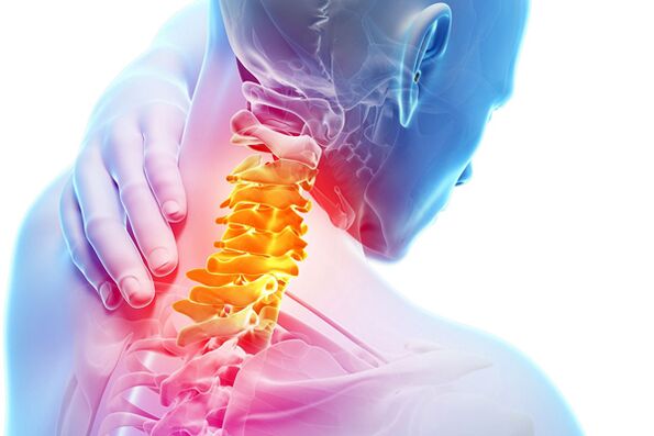 Шийний остеохондроз